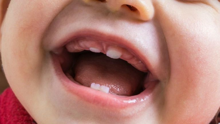 Đo thân nhiệt đúng cách giúp xác định chính xác tình trạng sốt của trẻ