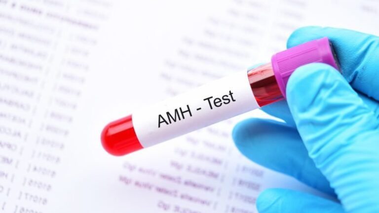 Xét nghiệm chỉ số AMH