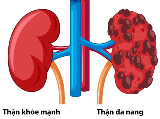 Hình minh họa theo dõi thai kỳ định kỳ giúp phát hiện và quản lý giãn bể thận thai nhi