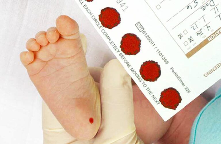 Hình ảnh minh họa bác sĩ lấy mẫu máu ở bé